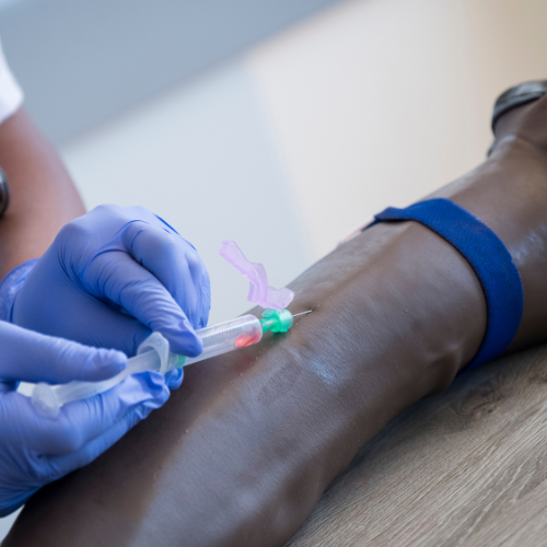 5 Steps to Practice IV Insertion Using a Mannequin Arm