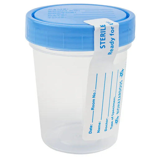 A clear plastic specimen cup with a blue lid sits on a white background. A label on the cup is marked "STERILE Ready for use" and includes spaces for patient information. The biohazard symbol is also present.