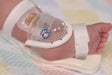 A baby's foot is secured in a white plastic device with straps. A small sticker shows a sleeping cartoon animal. The context is a hospital crib.