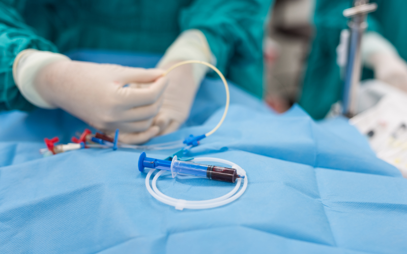 A syringe containing blood rests on a surgical drape. A gloved surgeon manipulates a catheter nearby, during a medical procedure.