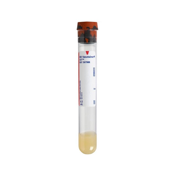 A BD Vacutainer SST™ tube contains a pale yellow liquid; it is labeled "BD Vacutainer® SST™ REF 367968".