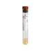 A BD Vacutainer SST™ tube contains a pale yellow liquid; it is labeled "BD Vacutainer® SST™ REF 367968".