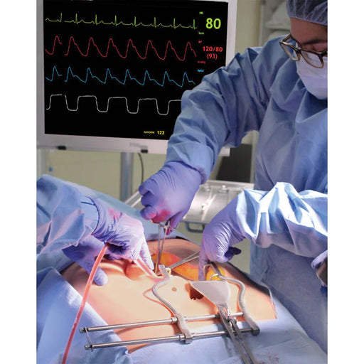 Gloved hands perform surgery on an exposed abdomen, using surgical instruments. The context is a sterile operating room.