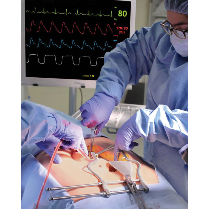 Gloved hands perform surgery on an exposed abdomen, using surgical instruments. The context is a sterile operating room.