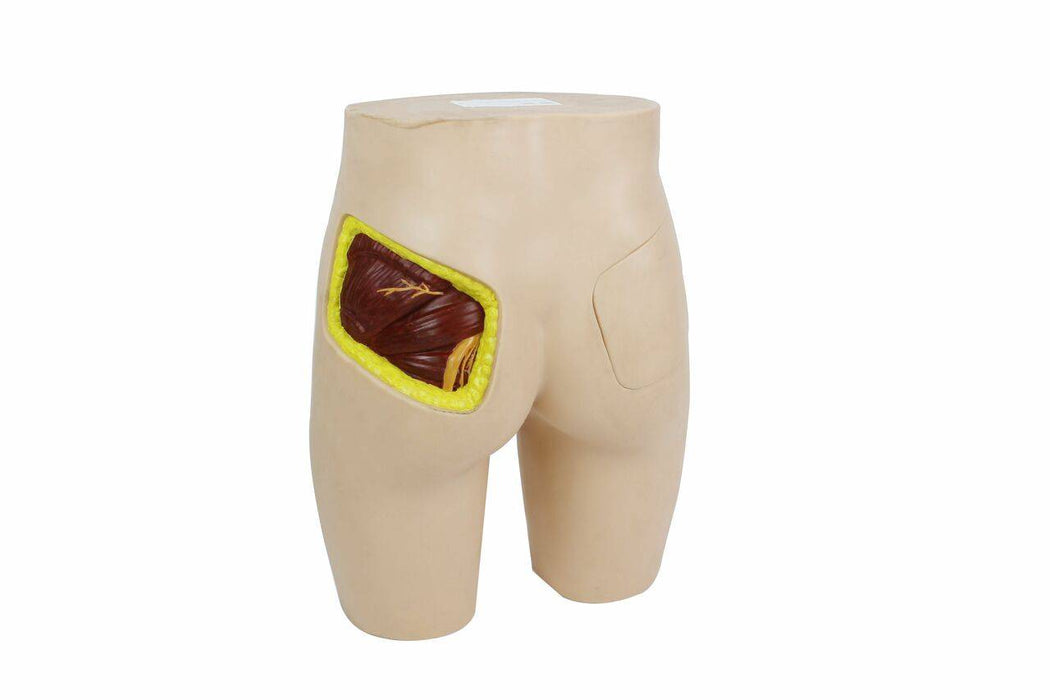 A beige anatomical model of buttocks displays a dissected gluteus medius muscle, highlighted by yellow borders, against a white background.