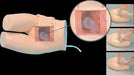 A medical training mannequin depicting a pelvic region, showcasing a simulated procedure, is presented alongside instructional images demonstrating the steps involved.
