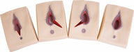 Four beige, rectangular models depict simulated vaginal lacerations of varying degrees; the models show progressive stages of a tear.
