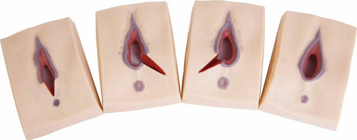Four beige, rectangular models depict simulated vaginal lacerations of varying degrees; the models show progressive stages of a tear.