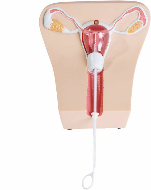 A medical model of female reproductive organs features a partially transparent uterus with an IUD. A white string extends down, in a white background.