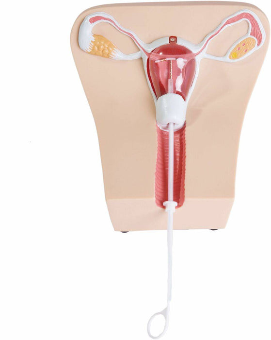 A medical model of female reproductive organs features a partially transparent uterus with an IUD. A white string extends down, in a white background.