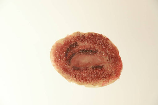 A simulated wound rests on a white surface. It is an oval, reddish-brown scab-like substance with darker inner markings.