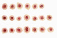 Twenty simulated bullet wounds are arranged in four rows on a white background. Each wound is a small, flesh-toned circle with a central, red dot simulating blood.