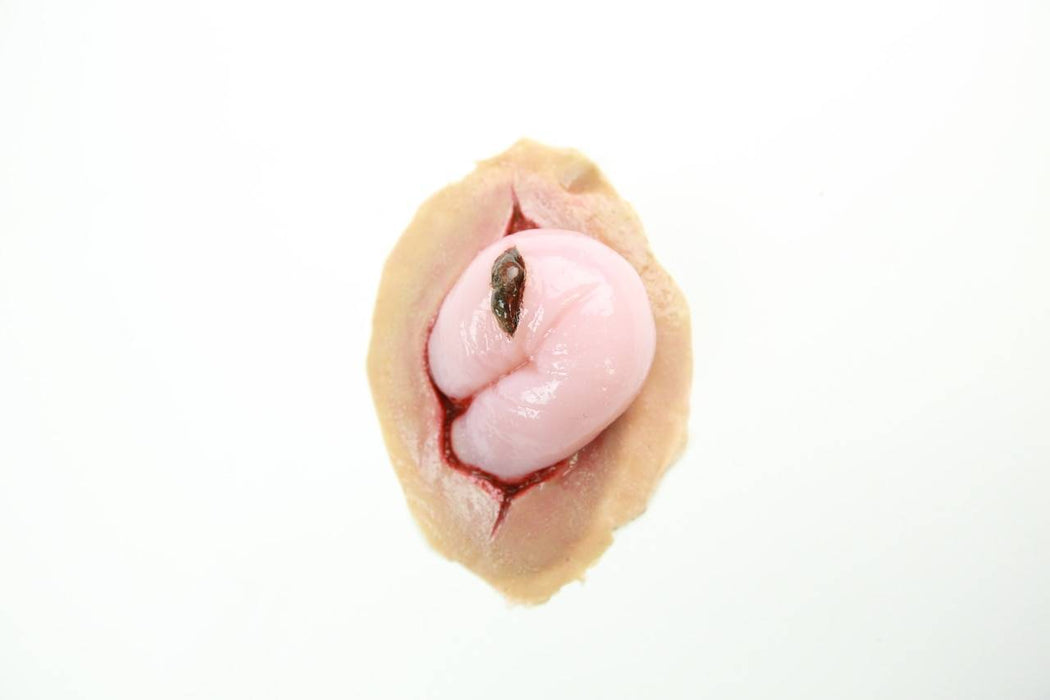 A pink, fleshy mass protrudes from a simulated wound; a small, dark object rests atop it. The simulated wound is on a flesh-toned background.