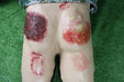 A training dummy displays simulated burns and lacerations on its buttocks and thighs; it rests on artificial turf.