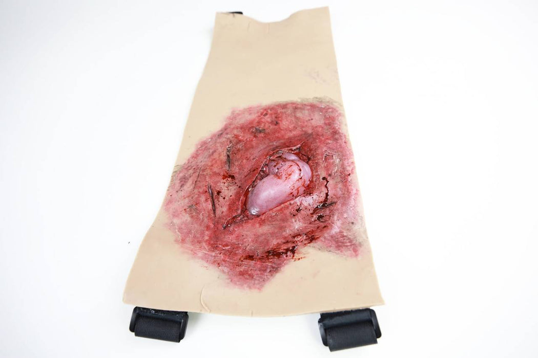 A simulated, lacerated wound, exhibiting a fleshy protrusion and bleeding, is affixed to a beige, fabric-like backing with straps.