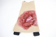 A simulated, lacerated wound, exhibiting a fleshy protrusion and bleeding, is affixed to a beige, fabric-like backing with straps.