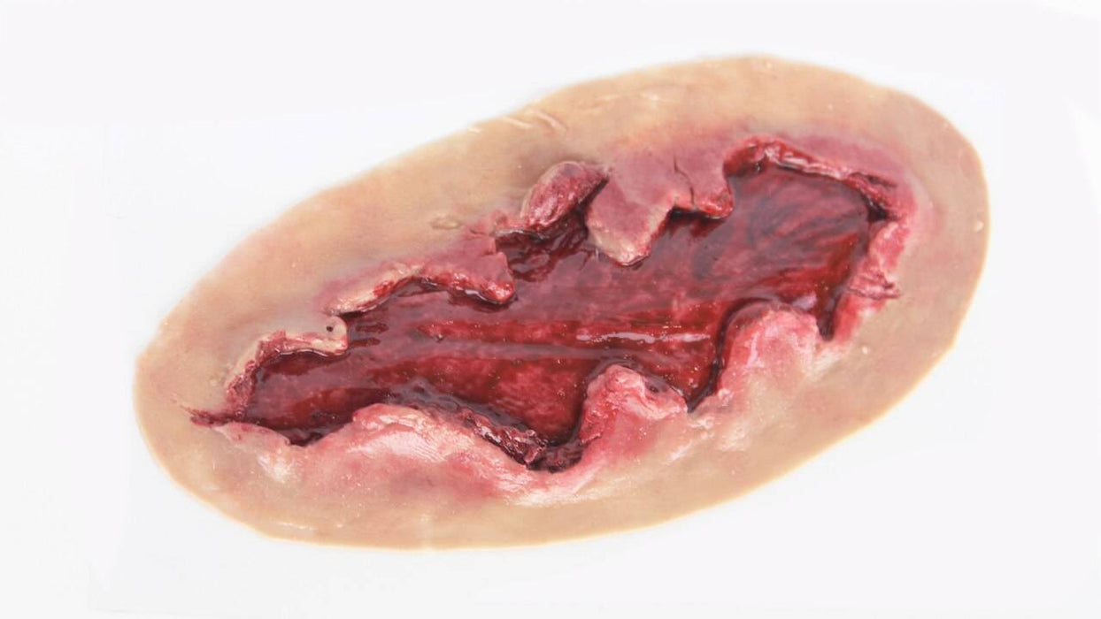 A simulated, deep wound with ragged edges displays exposed, bloody tissue; it rests on a plain, white background.