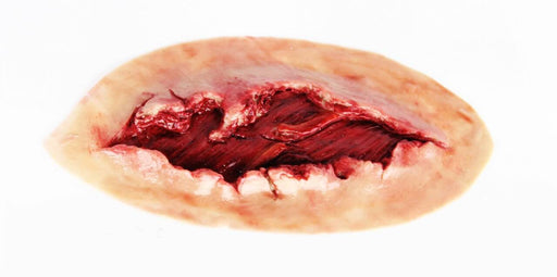 A wound, exhibiting a deep gash revealing exposed flesh and blood, is shown against a white background.