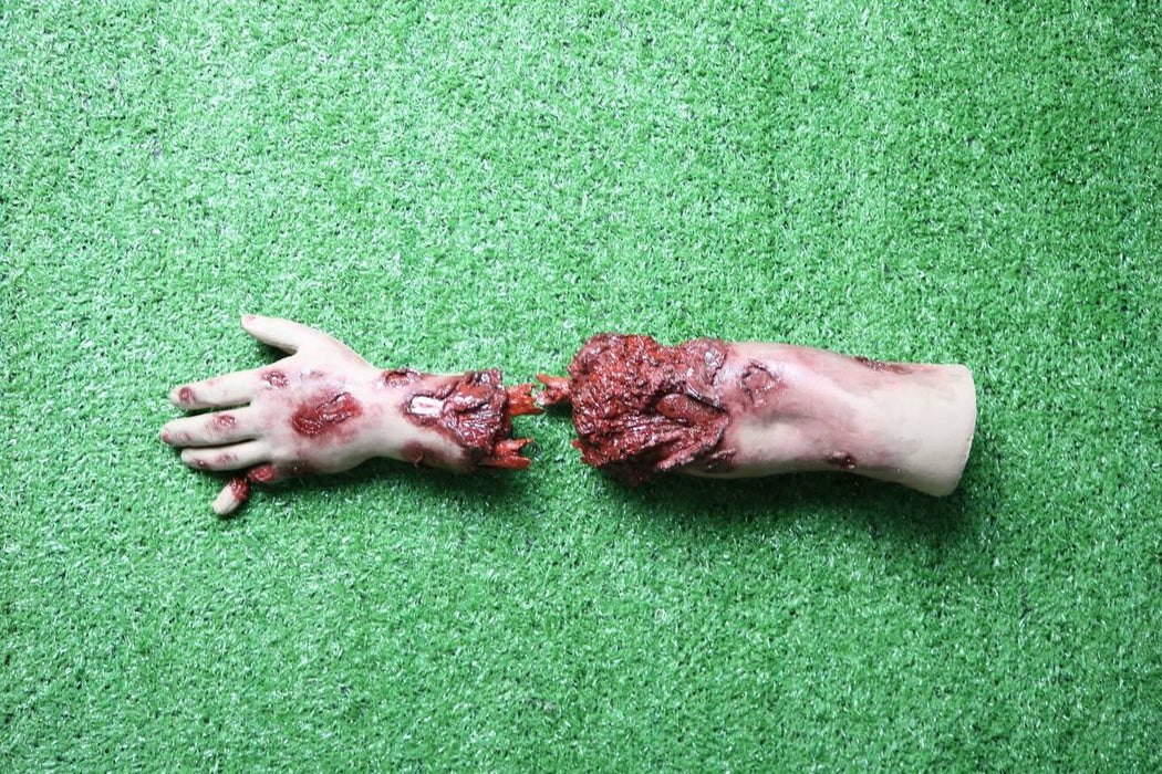 A severed, bloody arm lies on artificial turf; the hand is outstretched.