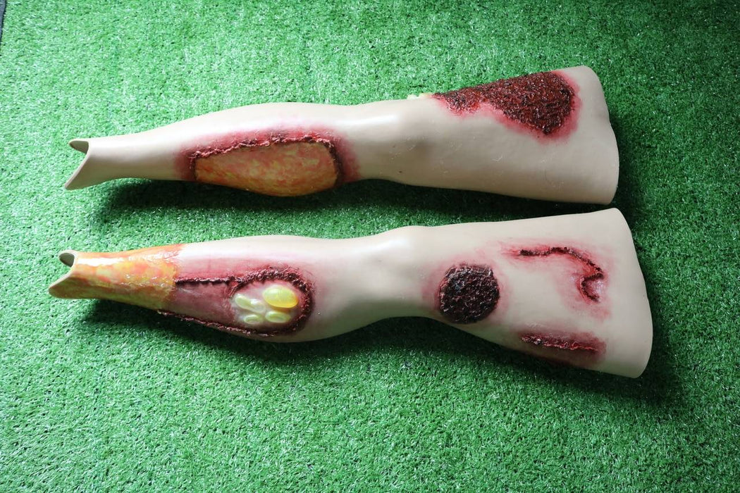 Two artificial legs, showing simulated injuries, rest on a green surface. The injuries appear as discolored, bruised areas and simulated wounds.