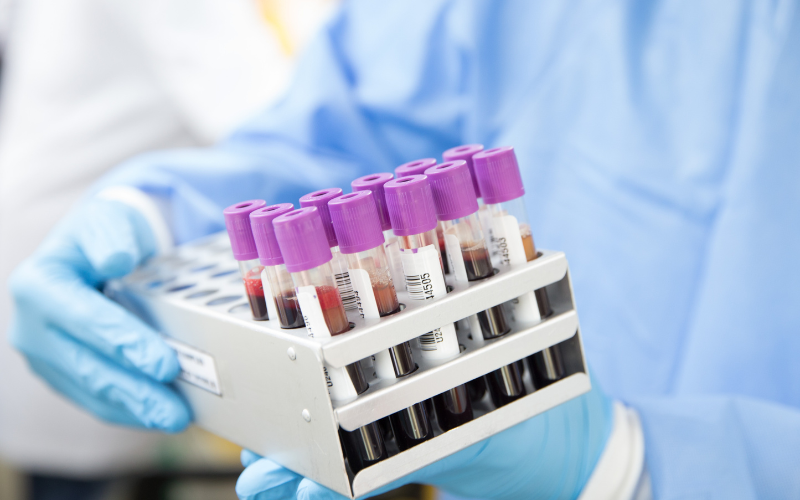 What are Lab Consumables?